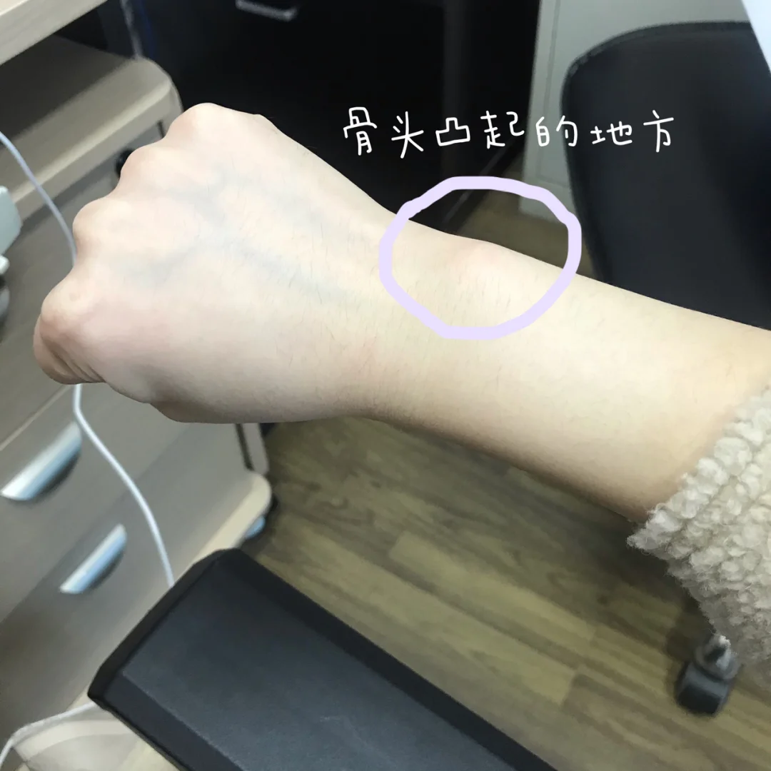 星空体育-季后赛带伤作战！杰威接受右手韧带撕裂修复手术的简单介绍